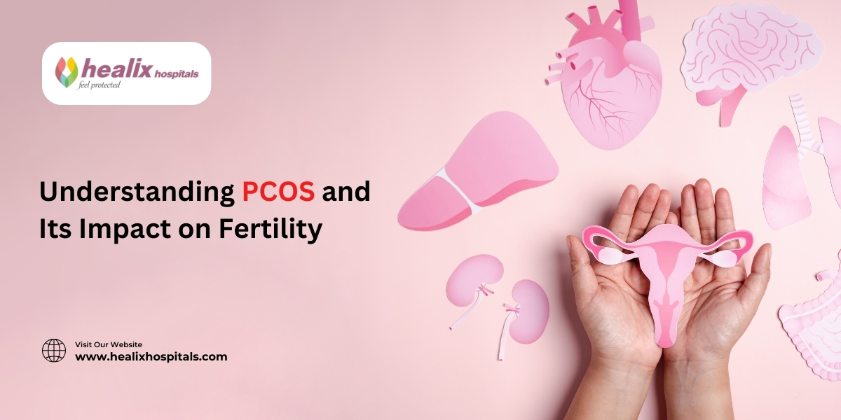 Understanding PCOS and Its Impact on Fertility